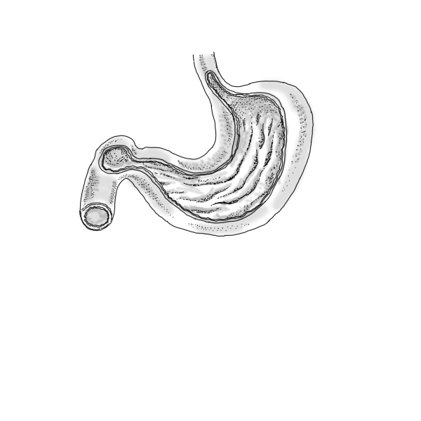 Stomach (1)
